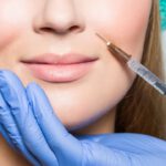 Lip Filler Simulation: Envision Your Ideal Aesthetic!